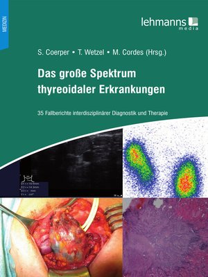 cover image of Das große Spektrum thyreoidaler Erkrankungen